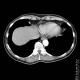 Thorax 47